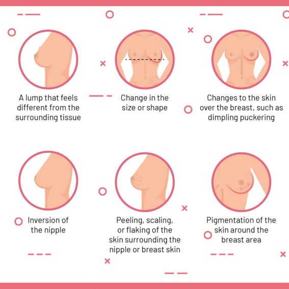 Lump In Breast: Cancerous Vs. Noncancerous
