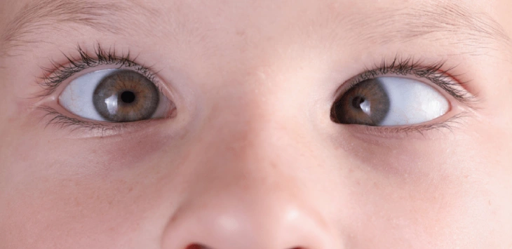 Pediatric ophthalmologist in Mumbai